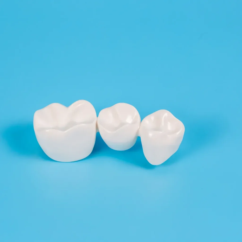 Benefits of Same Day Crown Technology