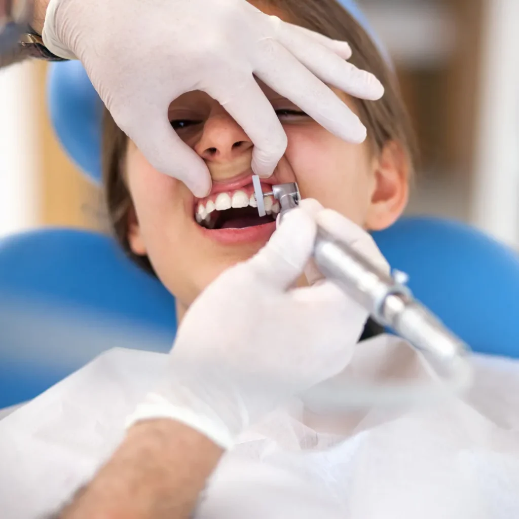 Deep Cleaning Teeth Treatment