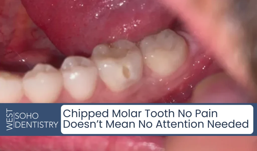 Chipped Molar Tooth No Pain Doesn’t Mean No Attention Needed