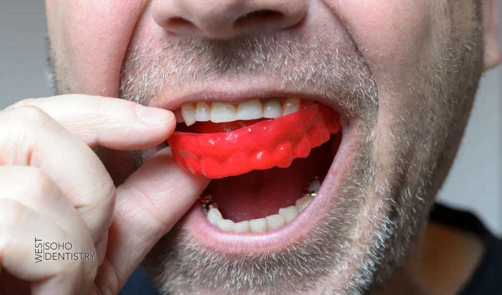 Preventing Chipped Teeth