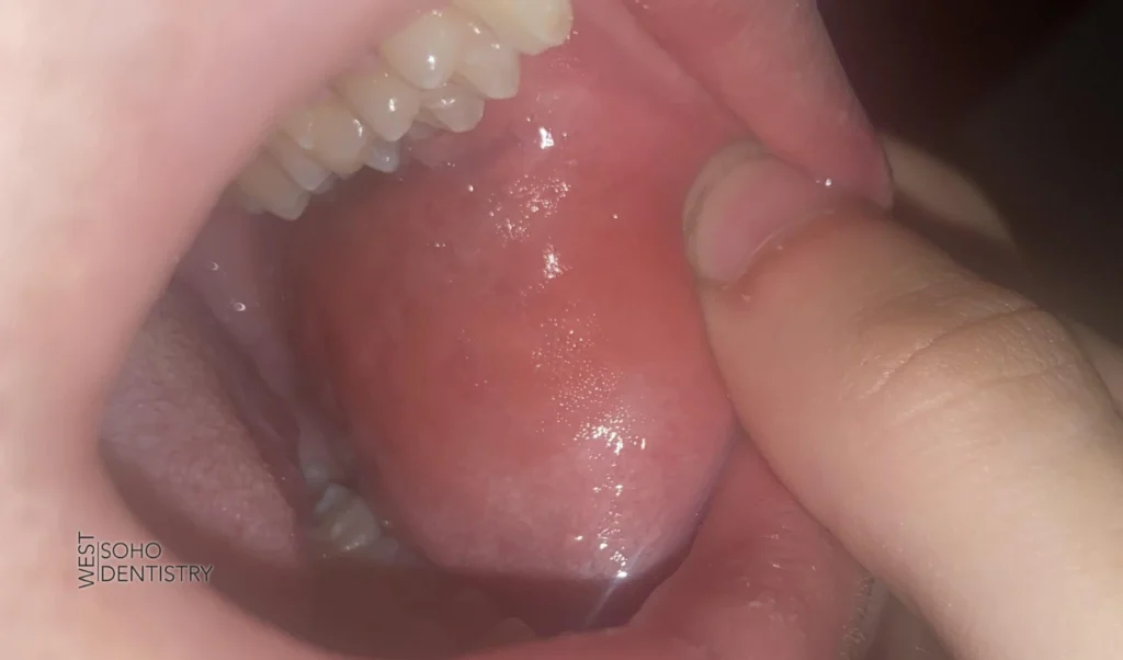 Why Ignoring It Completely Is Not Ideal