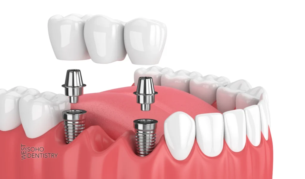 Common Procedures That Affect Cost