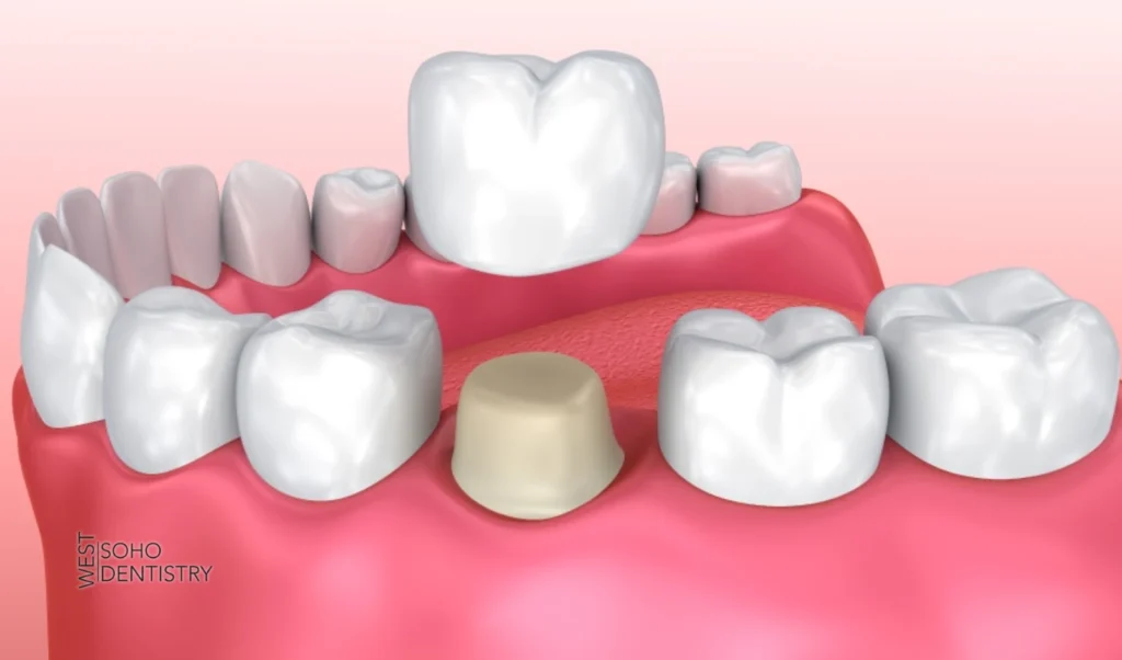 How This Differs From Regular Dentistry